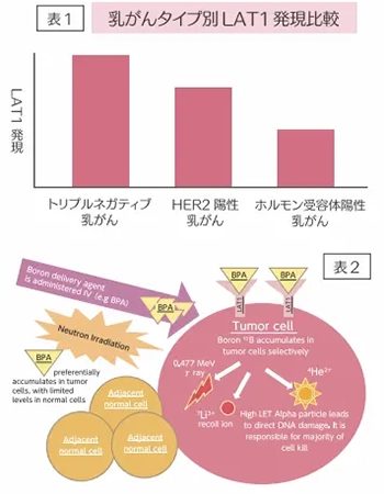 乳がんのタイプ別LAT1発現比較