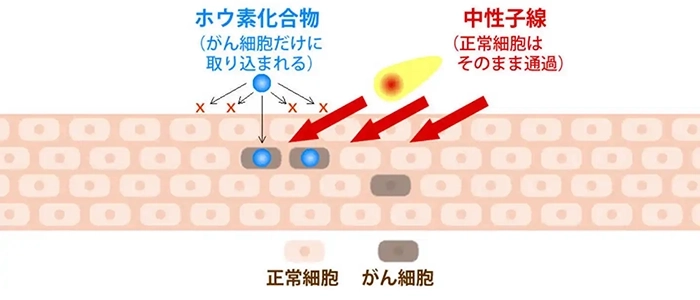 BNCTのホウ素化合物と中性子線ががん細胞に作用する仕組み