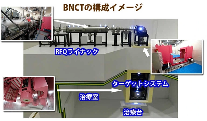 BNCTの構成イメージ