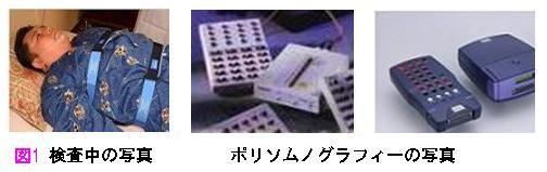 ポリソムノグラフィー検査中の写真