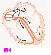 心房頻拍の図