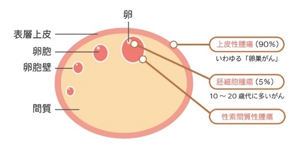 子宮画像