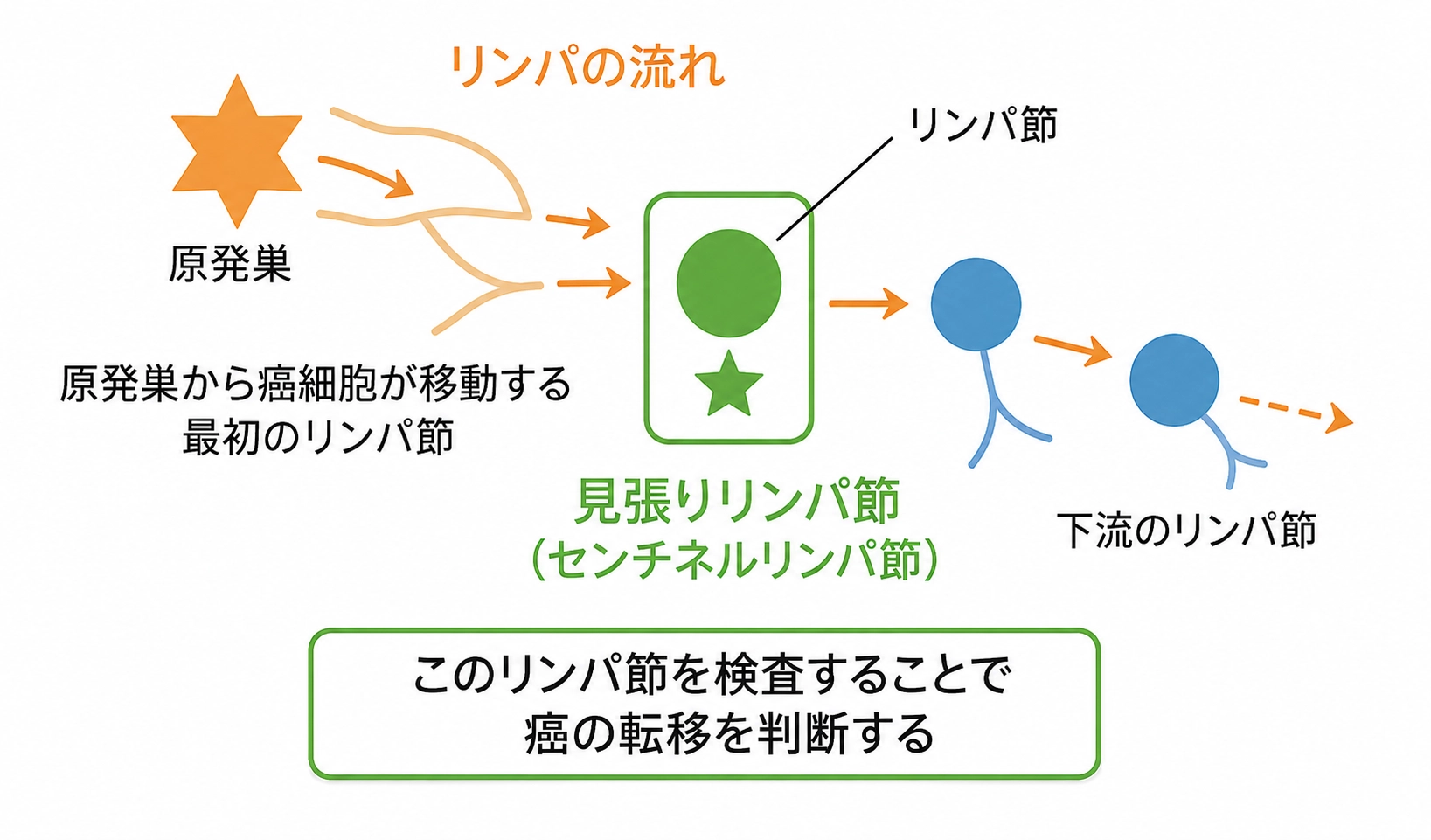 リンパの流れセンチネルリンパ節