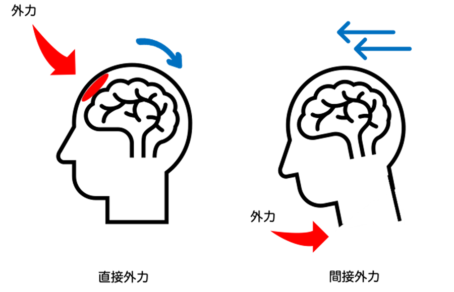水疱の集簇と痂皮化した病変