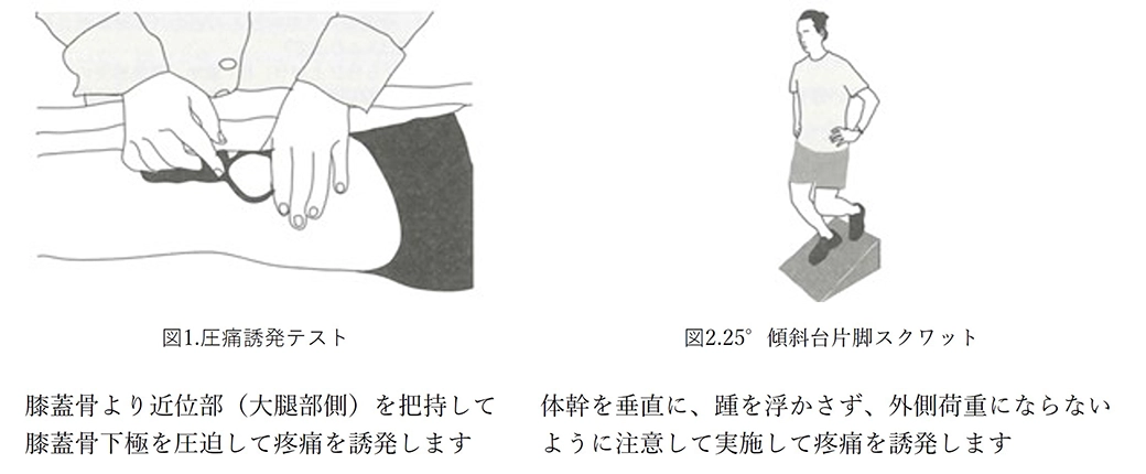 ジャンパー膝診断 身体所見