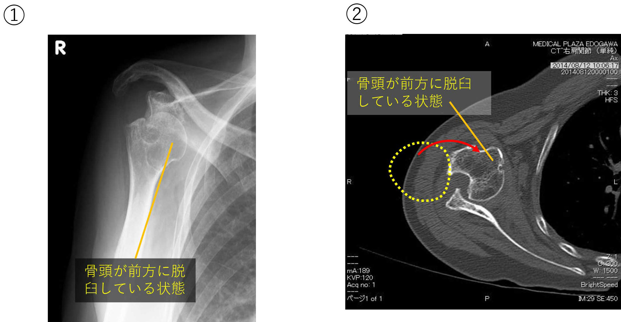 レントゲン、CTの画像