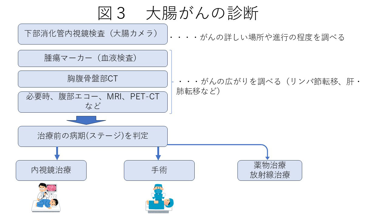 大腸がんの診断