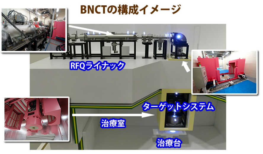 BNCTの構造イメージ