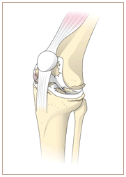 変形性関節症のイメージ画像