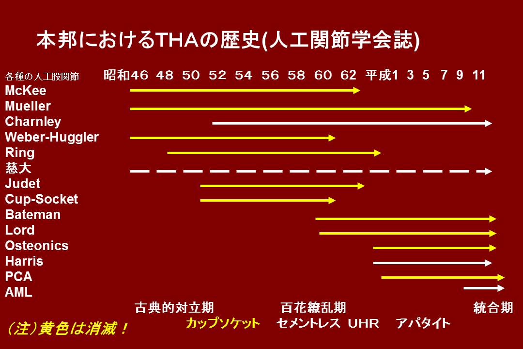 人工股関節の歴史