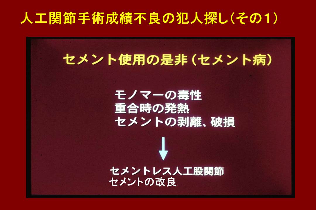 人工関節手術成績不良の犯人探し(その1)