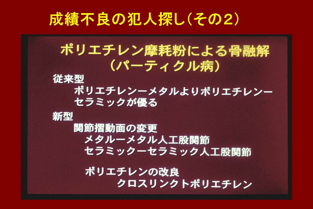 人工関節手術成績不良の犯人探し(その2)