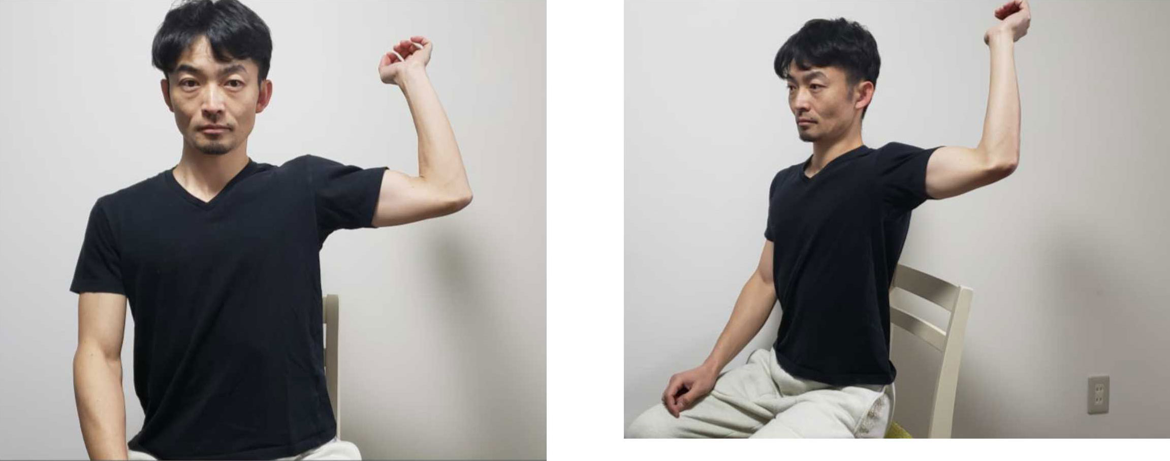 反復性肩関節脱臼 | スポーツ医学科の主な疾患と治療方法 | 江戸川病院